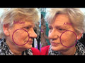FaceLift Serum Rimpels Kraaienpotenz und Wallen